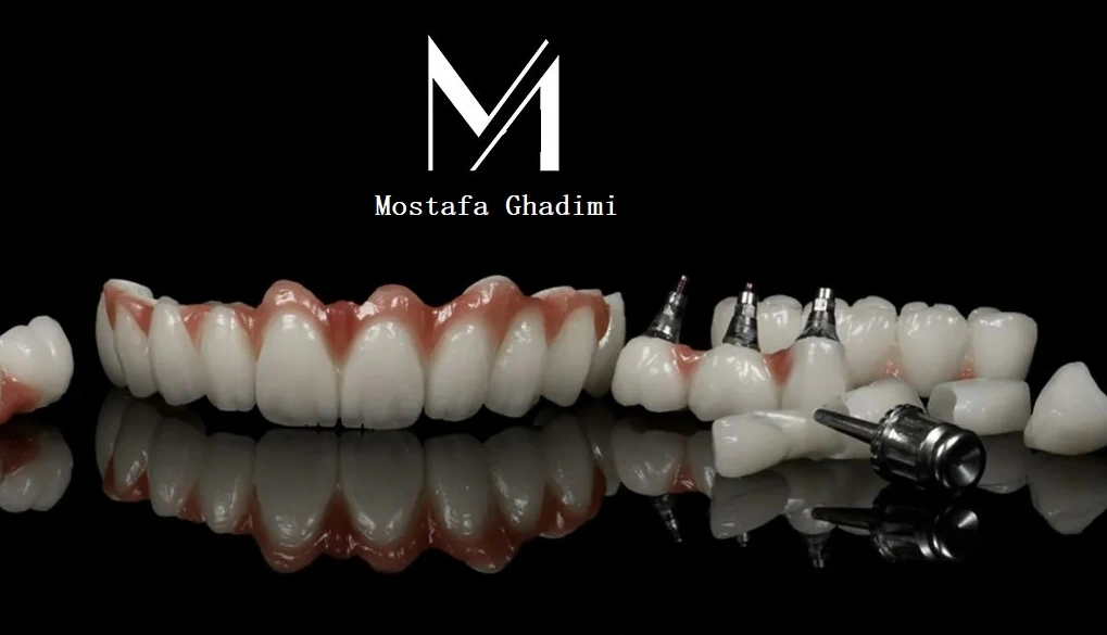 نمونه کار لابراتوار دندانسازی قدیمی